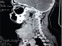 blog post